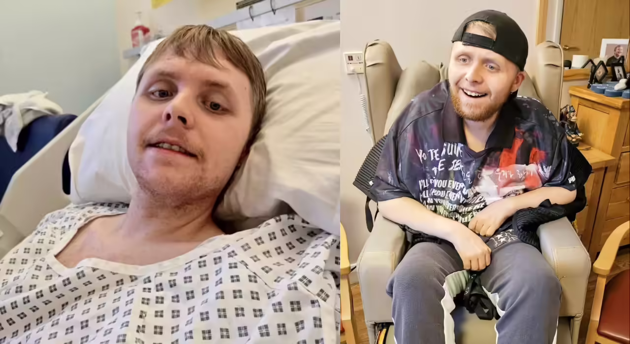 UK’s youngest dementia patient dies at 24; doctors say he had the brain of a 70-year-old