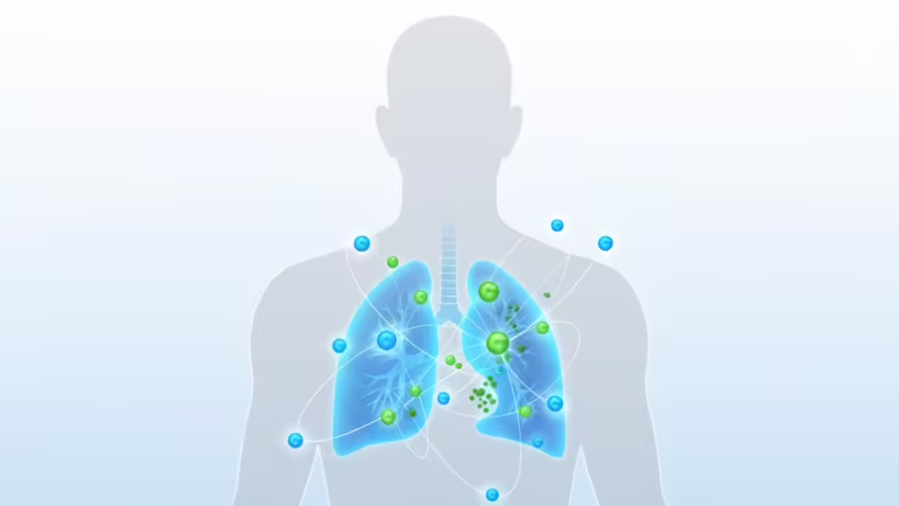 What is Anktiva? Saudi Arabia approves new lung cancer therapy first in world